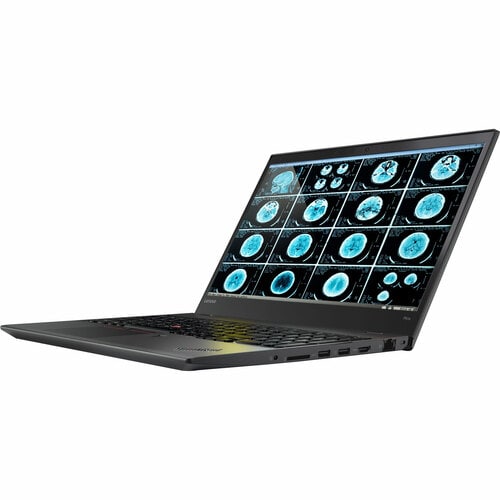 Station de travail mobile Lenovo ThinkPad P51s 20HB001KCA 15,6 pouces