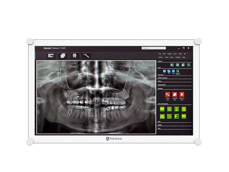 Écran Ag 21,5 pouces FHD 1920 x 1080, 500 nits, 1000:1, 5 ms, 178/178, Dicom M