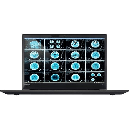 Station de travail mobile Lenovo ThinkPad P51s 20HB001KCA 15,6 pouces
