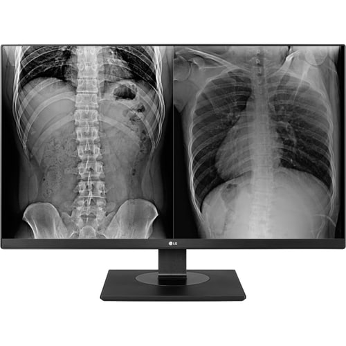 LG 27HJ713C-B 27\" Class 4K UHD LCD Monitor - 16:9