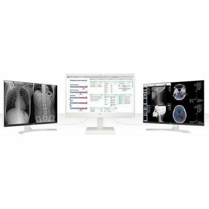 LG 24CN670W-AP Todo en uno